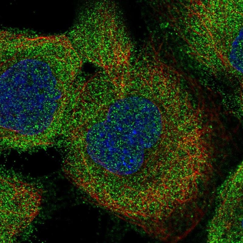 Staining of human cell line A-431 shows localization to cytosol.