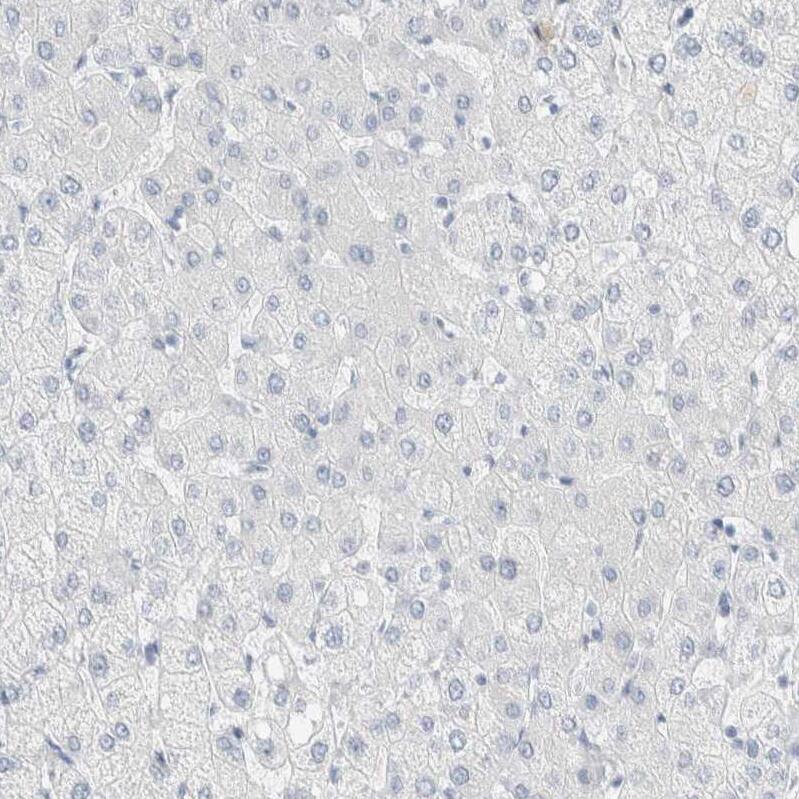 Staining of human liver shows no positivity in hepatocytes as expected.