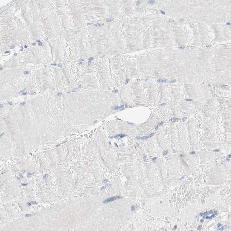 Staining of human skeletal muscle shows no positivity in myocytes as expected.