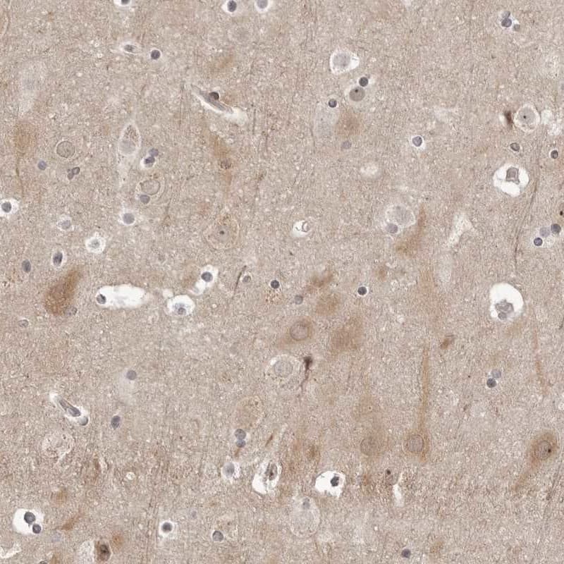 Staining of human cerebral cortex shows moderate positivity in  neuronal and glial cells and in neuropil.