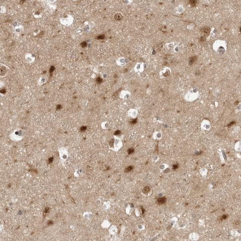 Immunohistochemistry-Paraffin PYK2/FAK2 Antibody - BSA Free