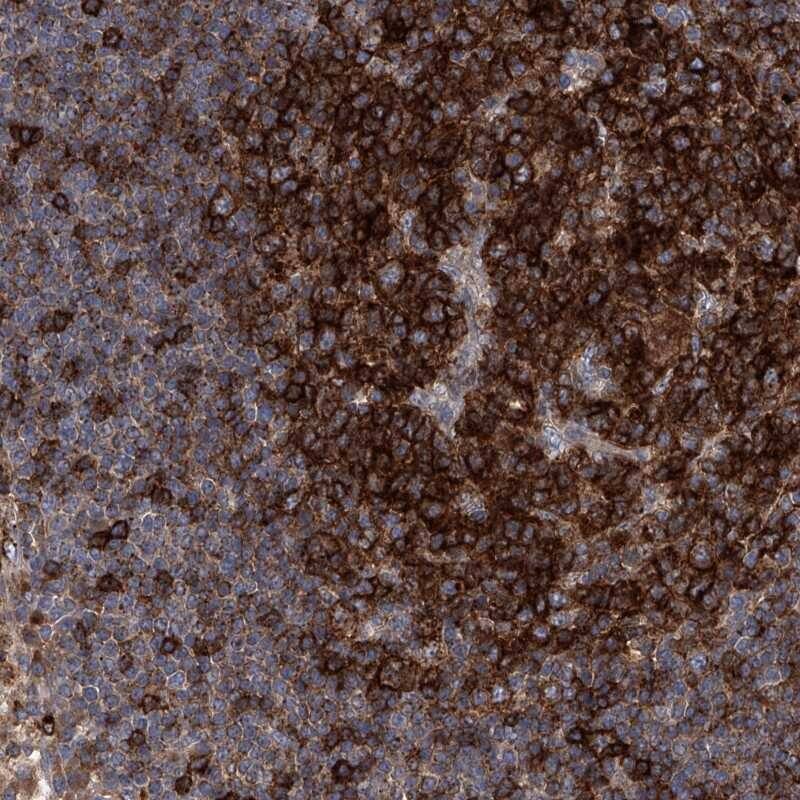 Staining of human lymph node shows strong cytoplasmic positivity in reaction center cells.