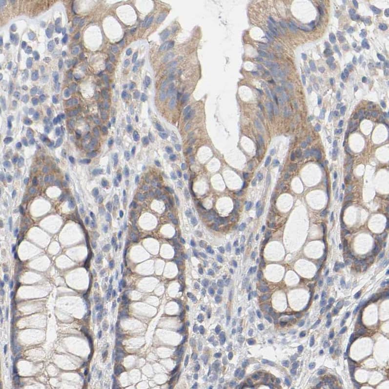 Staining of human rectum shows moderate cytoplasmic positivity in glandular cells.