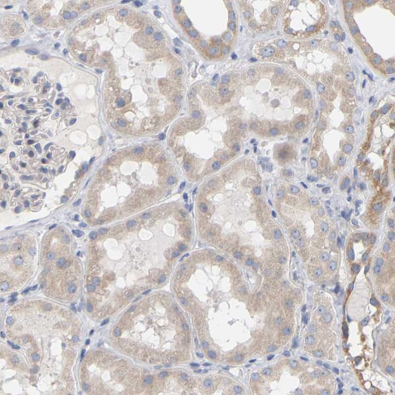 Staining of human kidney shows moderate cytoplasmic positivity in cells in tubules.