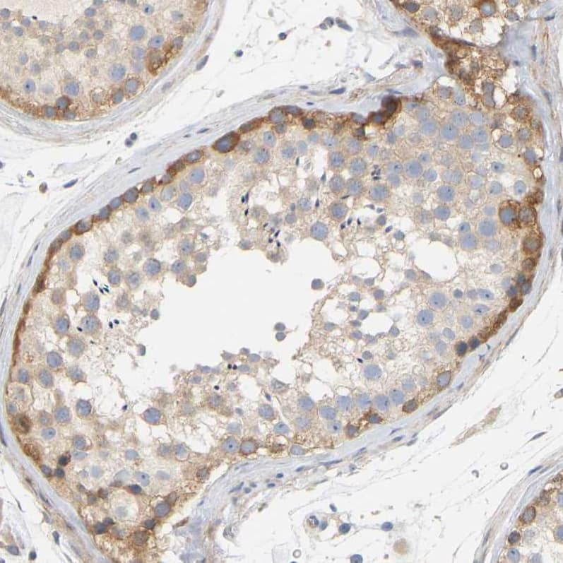 Staining of human testis shows strong cytoplasmic positivity in spermatogonia.