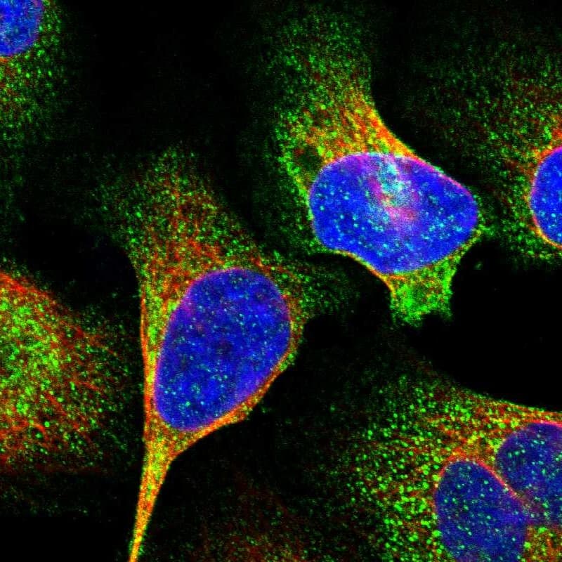 Staining of human cell line U-2 OS shows localization to cytosol.