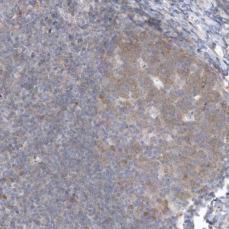 Immunohistochemistry ZC3H12D Antibody - BSA Free