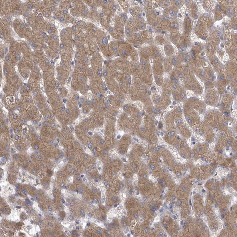 Staining of human liver shows moderate cytoplasmic positivity in hepatocytes.