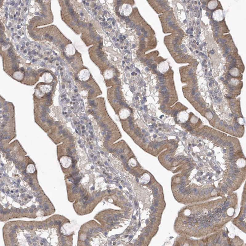 Staining of human duodenum shows moderate cytoplasmic positivity in glandular cells.