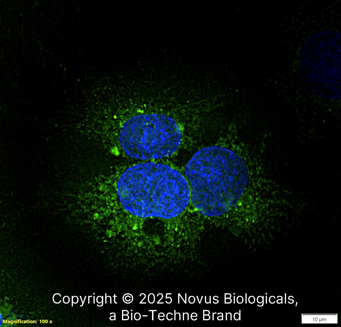 Fibronectin was detected in immersion fixed HepG2 human hepatocellular carcinoma cell line using Rabbit anti-Fibronectin Affinity Purified Polyclonal Antibody conjugated to FITC (Catalog # NBP1-91258F) (green) at 10 µg/mL overnight at 4C. Cells were counterstained with DAPI (dark blue). Cells were imaged using a 100X objective and digitally deconvolved.