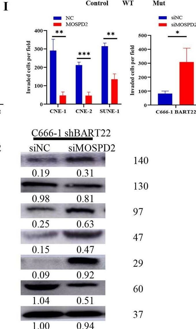MOSPD2 is a direct target of EBV-miR-BART22.A A Venn diagram depicting the overlap of target genes predicted by TargetScan (green), RNA-sequencing (red), DIANA (blue), and Vir-Mir (yellow). Putative target genes identified by this approach are listed. B Quantitative reverse transcription-polymerase chain reaction (qRT-PCR) analysis of EBV-miR-BART22 regulation on target genes in nasopharyngeal carcinoma cells. C Expression of MOSPD2 in indicated cells was examined by WB analysis. D The relative expression levels of MOSPD2 in normal nasopharyngeal tissues and nasopharyngeal tumors in the GEO data set for nasopharyngeal carcinoma. E The construction of luciferase reporter vectors with inserted WT or mutant MOSPD2 3′-UTR sequences. F Changes in the normalized reporter gene activities of WT and mutant MOSPD2 3′-UTR luciferase reporter constructs responded to the co-transfection of negative control (NC) or EBV-miR-BART22 mimic in T293 cells. G Representative photomicrographs of scratch wounds at 0 and 24 h after wounds were made. Quantitative measurement of wound gaps by Photoshop software. H Quantification of indicated migrating cells in 5 random fields analyzed by Transwell assays, respectively. I Quantification of indicated migrating cells in 5 random fields analyzed by invasion assays, respectively. J Expression of epithelial cell marker, mesenchymal cell marker,  beta -catenin, and MOSPD2 in indicated cells were examined by WB analysis. GAPDH was used as a loading control. Image collected and cropped by CiteAb from the following open publication (//pubmed.ncbi.nlm.nih.gov/35907914), licensed under a CC-BY license. Not internally tested by Novus Biologicals.