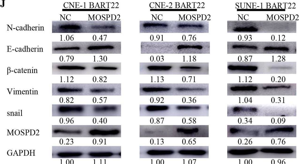 MOSPD2 is a direct target of EBV-miR-BART22.A A Venn diagram depicting the overlap of target genes predicted by TargetScan (green), RNA-sequencing (red), DIANA (blue), and Vir-Mir (yellow). Putative target genes identified by this approach are listed. B Quantitative reverse transcription-polymerase chain reaction (qRT-PCR) analysis of EBV-miR-BART22 regulation on target genes in nasopharyngeal carcinoma cells. C Expression of MOSPD2 in indicated cells was examined by WB analysis. D The relative expression levels of MOSPD2 in normal nasopharyngeal tissues and nasopharyngeal tumors in the GEO data set for nasopharyngeal carcinoma. E The construction of luciferase reporter vectors with inserted WT or mutant MOSPD2 3′-UTR sequences. F Changes in the normalized reporter gene activities of WT and mutant MOSPD2 3′-UTR luciferase reporter constructs responded to the co-transfection of negative control (NC) or EBV-miR-BART22 mimic in T293 cells. G Representative photomicrographs of scratch wounds at 0 and 24 h after wounds were made. Quantitative measurement of wound gaps by Photoshop software. H Quantification of indicated migrating cells in 5 random fields analyzed by Transwell assays, respectively. I Quantification of indicated migrating cells in 5 random fields analyzed by invasion assays, respectively. J Expression of epithelial cell marker, mesenchymal cell marker,  beta -catenin, and MOSPD2 in indicated cells were examined by WB analysis. GAPDH was used as a loading control. Image collected and cropped by CiteAb from the following open publication (//pubmed.ncbi.nlm.nih.gov/35907914), licensed under a CC-BY license. Not internally tested by Novus Biologicals.