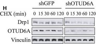 Western Blot: OTUD6A Antibody [NBP1-91498] - OTUD6A deubiquitinates & affects Drp1 stability. Cells were infected with pLKO‐shOTUD6A or mock virus, selected by puromycin for 3 days to eliminate noninfected cells. (A) Depletion of OTUD6A in cells leads to decreased Drp1. Relative OTUD6A (B) & Drp1 (C) expression of (A) was further quantified. (D) Exogenous expression of OTUD6A causes the accumulation of Drp1 in HCT116 (left) & DLD1 (right) cells. (E) Relative Drp1 expression of (D) was further quantified. (F) HCT116 cells transfected with pLKO‐shOTUD6A were left untreated or treated with proteasome inhibitor MG132 (10 μm, 12 h), & the proteins were extracted & subjected to western blotting. (G) Relative Drp1 expression of (F) was further quantified. (H, I) Half‐life analysis of Drp1 in HCT116 cells with & without knockdown of OTUD6A. (J, K) Half‐life analysis of Drp1 in DLD1 cells expressing OTUD6A. (L) OTUD6A inhibits Drp1 ubiquitination in cells. IB analysis of Ni‐NTA pull‐down products & WCL derived from HEK293 cells transfected with the indicated constructs. (M) OTUD6A WT but not the mutant C152A deubiquitinates Drp1. The mean ± SD for three independent experiments is shown. For two groups, data were analyzed by unpaired, two‐tailed Student's t‐test. **P < 0.01, ***P < 0.001. Other data were analyzed by one‐way ANOVA, followed by a Bonferroni post hoc test. **P < 0.01, ***P < 0.001. Image collected & cropped by CiteAb from the following publication (//pubmed.ncbi.nlm.nih.gov/33070427), licensed under a CC-BY license. Not internally tested by Novus Biologicals.