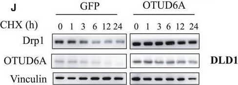Western Blot: OTUD6A Antibody [NBP1-91498] - OTUD6A deubiquitinates & affects Drp1 stability. Cells were infected with pLKO‐shOTUD6A or mock virus, selected by puromycin for 3 days to eliminate noninfected cells. (A) Depletion of OTUD6A in cells leads to decreased Drp1. Relative OTUD6A (B) & Drp1 (C) expression of (A) was further quantified. (D) Exogenous expression of OTUD6A causes the accumulation of Drp1 in HCT116 (left) & DLD1 (right) cells. (E) Relative Drp1 expression of (D) was further quantified. (F) HCT116 cells transfected with pLKO‐shOTUD6A were left untreated or treated with proteasome inhibitor MG132 (10 μm, 12 h), & the proteins were extracted & subjected to western blotting. (G) Relative Drp1 expression of (F) was further quantified. (H, I) Half‐life analysis of Drp1 in HCT116 cells with & without knockdown of OTUD6A. (J, K) Half‐life analysis of Drp1 in DLD1 cells expressing OTUD6A. (L) OTUD6A inhibits Drp1 ubiquitination in cells. IB analysis of Ni‐NTA pull‐down products & WCL derived from HEK293 cells transfected with the indicated constructs. (M) OTUD6A WT but not the mutant C152A deubiquitinates Drp1. The mean ± SD for three independent experiments is shown. For two groups, data were analyzed by unpaired, two‐tailed Student's t‐test. **P < 0.01, ***P < 0.001. Other data were analyzed by one‐way ANOVA, followed by a Bonferroni post hoc test. **P < 0.01, ***P < 0.001. Image collected & cropped by CiteAb from the following publication (//pubmed.ncbi.nlm.nih.gov/33070427), licensed under a CC-BY license. Not internally tested by Novus Biologicals.