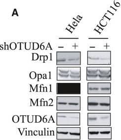 Western Blot: OTUD6A Antibody [NBP1-91498] - OTUD6A deubiquitinates & affects Drp1 stability. Cells were infected with pLKO‐shOTUD6A or mock virus, selected by puromycin for 3 days to eliminate noninfected cells. (A) Depletion of OTUD6A in cells leads to decreased Drp1. Relative OTUD6A (B) & Drp1 (C) expression of (A) was further quantified. (D) Exogenous expression of OTUD6A causes the accumulation of Drp1 in HCT116 (left) & DLD1 (right) cells. (E) Relative Drp1 expression of (D) was further quantified. (F) HCT116 cells transfected with pLKO‐shOTUD6A were left untreated or treated with proteasome inhibitor MG132 (10 μm, 12 h), & the proteins were extracted & subjected to western blotting. (G) Relative Drp1 expression of (F) was further quantified. (H, I) Half‐life analysis of Drp1 in HCT116 cells with & without knockdown of OTUD6A. (J, K) Half‐life analysis of Drp1 in DLD1 cells expressing OTUD6A. (L) OTUD6A inhibits Drp1 ubiquitination in cells. IB analysis of Ni‐NTA pull‐down products & WCL derived from HEK293 cells transfected with the indicated constructs. (M) OTUD6A WT but not the mutant C152A deubiquitinates Drp1. The mean ± SD for three independent experiments is shown. For two groups, data were analyzed by unpaired, two‐tailed Student's t‐test. **P < 0.01, ***P < 0.001. Other data were analyzed by one‐way ANOVA, followed by a Bonferroni post hoc test. **P < 0.01, ***P < 0.001. Image collected & cropped by CiteAb from the following publication (//pubmed.ncbi.nlm.nih.gov/33070427), licensed under a CC-BY license. Not internally tested by Novus Biologicals.