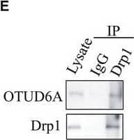 Western Blot: OTUD6A Antibody [NBP1-91498] - OTUD6A interacts with Drp1. (A) Drp1 specifically interacts with OTUD6A in cells. IB analysis of IP & WCL derived from HEK293 cells transfected with HA‐Drp1 & the indicated Flag‐DUBs for 48 h. (B) Overview of OTUD6A & Drp1 structures. (C) OTUD6A WT but not mutant C152A specifically interacts with Drp1. (D) HEK293 cells transfected with the Drp1 constructs were subjected to IP with the anti‐HA or anti‐Flag antibodies. (E) Drp1 interacts with endogenous OTUD6A in cells. HEK293 cell lysates were subjected to pull down by anti‐Drp1 antibody & protein A/G agarose, followed by IB analysis with the indicated antibodies. (F) HeLa cells were fixed & immunostained with anti‐Drp1 & anti‐OTUD6A before confocal microscopy. The magnification of the images is 400×. (G) Quantification of the colocalization between Drp1 & OTUD6A. Scale bar represents 40 μm. Image collected & cropped by CiteAb from the following publication (//pubmed.ncbi.nlm.nih.gov/33070427), licensed under a CC-BY license. Not internally tested by Novus Biologicals.