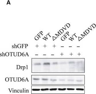 Western Blot: OTUD6A Antibody [NBP1-91498] - Decreased cancer cell growth induced by OTUD6A can be partly restored by Drp1 expression. (A) HeLa cells were infected with pLKO‐shOTUD6A, selected by puromycin for 3 days. OTUD6A−/− cells were then infected with Drp1‐WT or Drp1‐ delta MDVD, selected by hygro for 3 days. (B) Fluorescence staining of mitochondrial morphology in HeLa cells stably knockdown OTUD6A & express Drp1‐WT or Drp1‐ delta MDVD. The magnification of the images is 400×. (C) The length of mitochondrial fragments in the indicated HeLa cells. (D) Cell growth of indicated cells. (E) Colony formation of the indicated cells. (F) Relative colony numbers were further quantified to determine the extent of the colony formation. The mean ± SD for three independent experiments is shown. Data were analyzed by one‐way or two‐way ANOVA, followed by a Bonferroni post hoc test. *P < 0.05, **P < 0.01, ***P < 0.001. For image C & F, *P < 0.05, ***P < 0.001 GFP vs WT. #P < 0.05, ###P < 0.001 WT vs.  delta MDVD; ^P < 0.05, ^^P < 0.01, ^^^P < 0.001 shGFP + GFP vs. shOTUD6A. For image D, ***P < 0.001 shGFP + GFP vs. shOTUD6A + GFP; ^^^P < 0.001 shGFP + GFP vs. shOTUD6A +  delta MDVD. Scale bar represents 40 μm. Image collected & cropped by CiteAb from the following publication (//pubmed.ncbi.nlm.nih.gov/33070427), licensed under a CC-BY license. Not internally tested by Novus Biologicals.