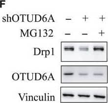 Western Blot: OTUD6A Antibody [NBP1-91498] - OTUD6A deubiquitinates & affects Drp1 stability. Cells were infected with pLKO‐shOTUD6A or mock virus, selected by puromycin for 3 days to eliminate noninfected cells. (A) Depletion of OTUD6A in cells leads to decreased Drp1. Relative OTUD6A (B) & Drp1 (C) expression of (A) was further quantified. (D) Exogenous expression of OTUD6A causes the accumulation of Drp1 in HCT116 (left) & DLD1 (right) cells. (E) Relative Drp1 expression of (D) was further quantified. (F) HCT116 cells transfected with pLKO‐shOTUD6A were left untreated or treated with proteasome inhibitor MG132 (10 μm, 12 h), & the proteins were extracted & subjected to western blotting. (G) Relative Drp1 expression of (F) was further quantified. (H, I) Half‐life analysis of Drp1 in HCT116 cells with & without knockdown of OTUD6A. (J, K) Half‐life analysis of Drp1 in DLD1 cells expressing OTUD6A. (L) OTUD6A inhibits Drp1 ubiquitination in cells. IB analysis of Ni‐NTA pull‐down products & WCL derived from HEK293 cells transfected with the indicated constructs. (M) OTUD6A WT but not the mutant C152A deubiquitinates Drp1. The mean ± SD for three independent experiments is shown. For two groups, data were analyzed by unpaired, two‐tailed Student's t‐test. **P < 0.01, ***P < 0.001. Other data were analyzed by one‐way ANOVA, followed by a Bonferroni post hoc test. **P < 0.01, ***P < 0.001. Image collected & cropped by CiteAb from the following publication (//pubmed.ncbi.nlm.nih.gov/33070427), licensed under a CC-BY license. Not internally tested by Novus Biologicals.