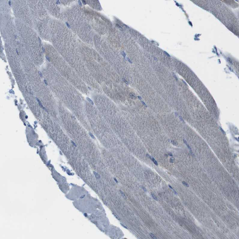 Staining of human skeletal muscle shows very weak cytoplasmic positivity in myocytes as expected.