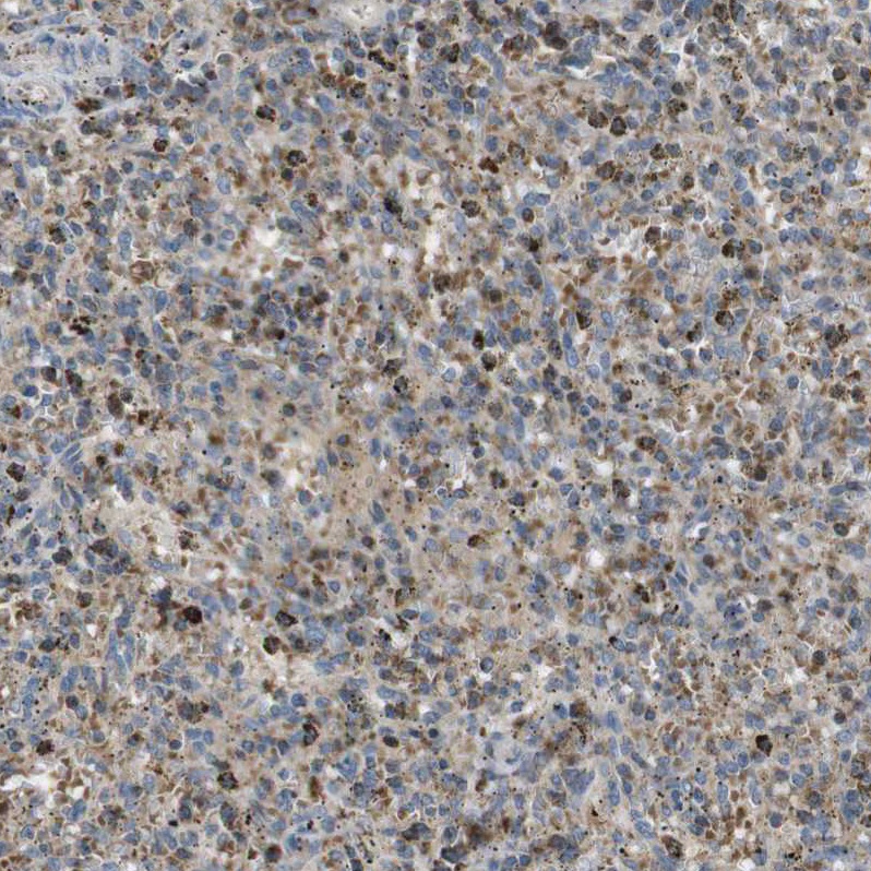 Staining of human spleen shows strong granular cytoplasmic positivity in cells in red pulp.