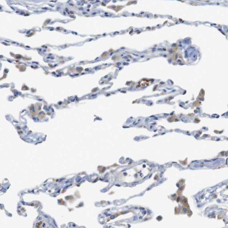 Staining of human lung shows weak cytoplasmic positivity in macrophages.
