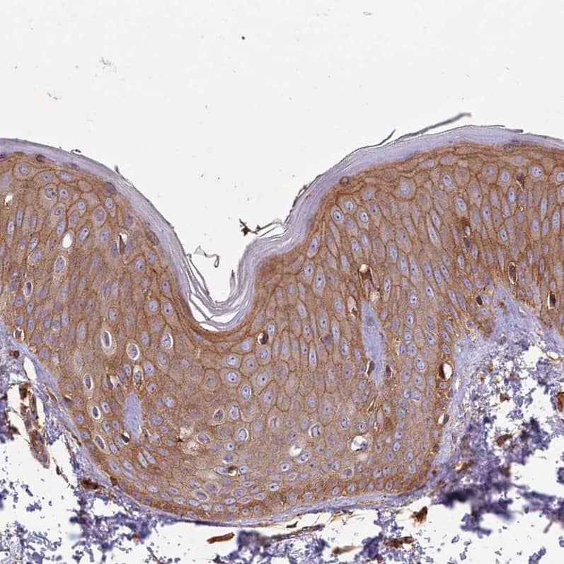Staining of human skin shows moderate to strong membranous positivity in squamous epithelial cells.