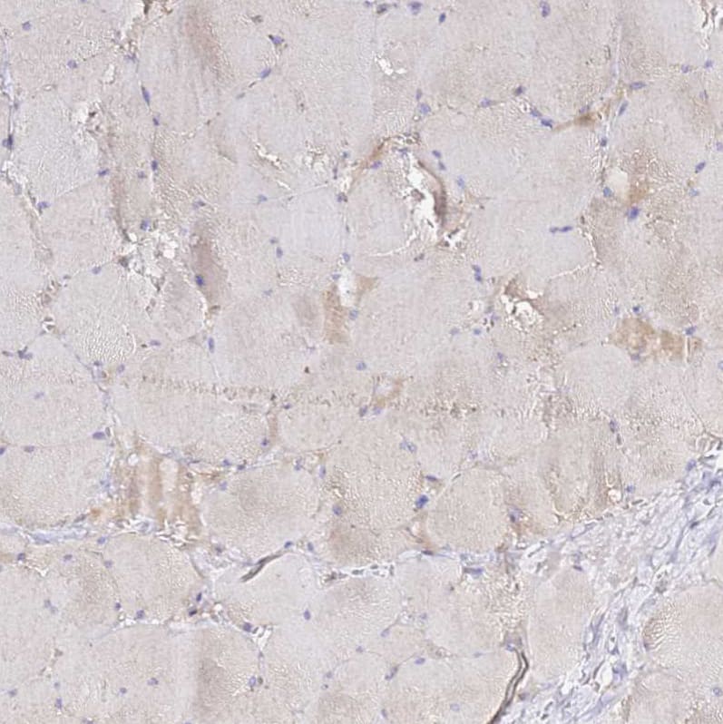 Staining of human skeletal muscle shows no positivity in myocytes as expected.