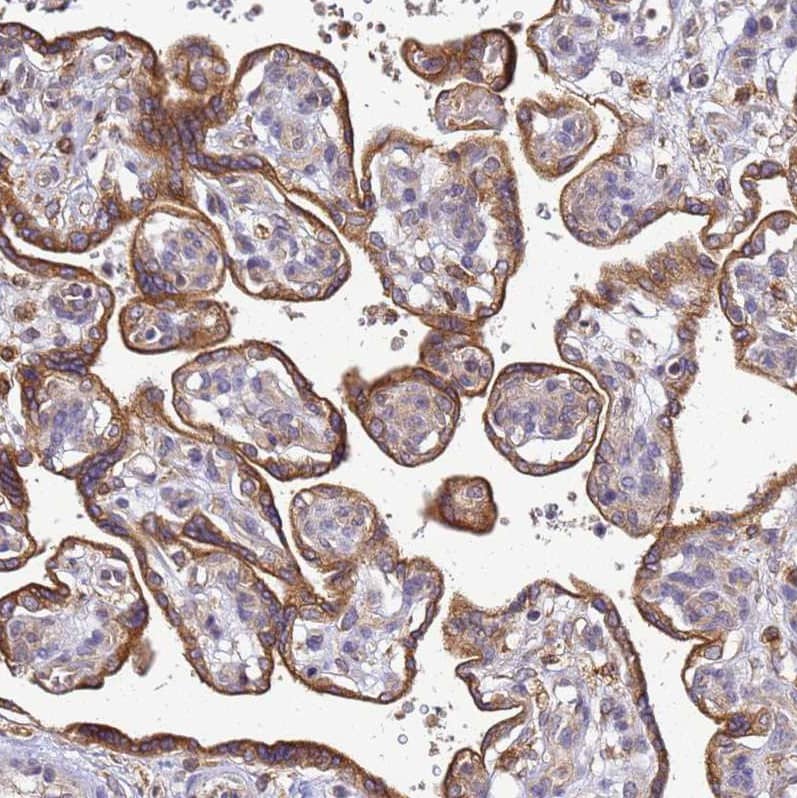 Staining of human placenta shows moderate granular cytoplasmic  positivity in trophoblastic cells.