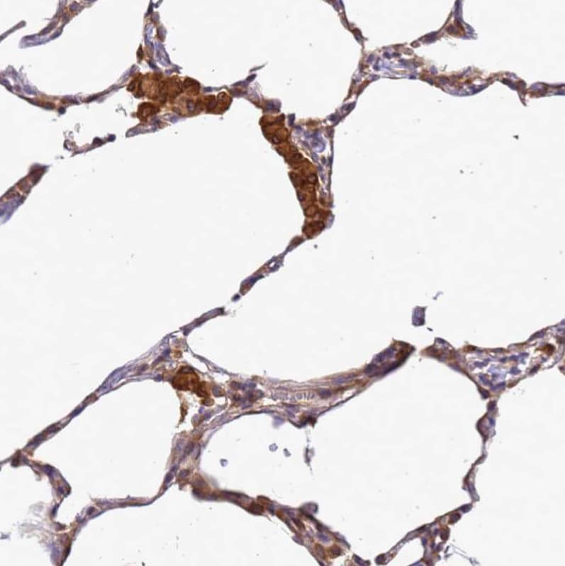 Staining of human lung shows strong cytoplasmic positivity in macrophages.
