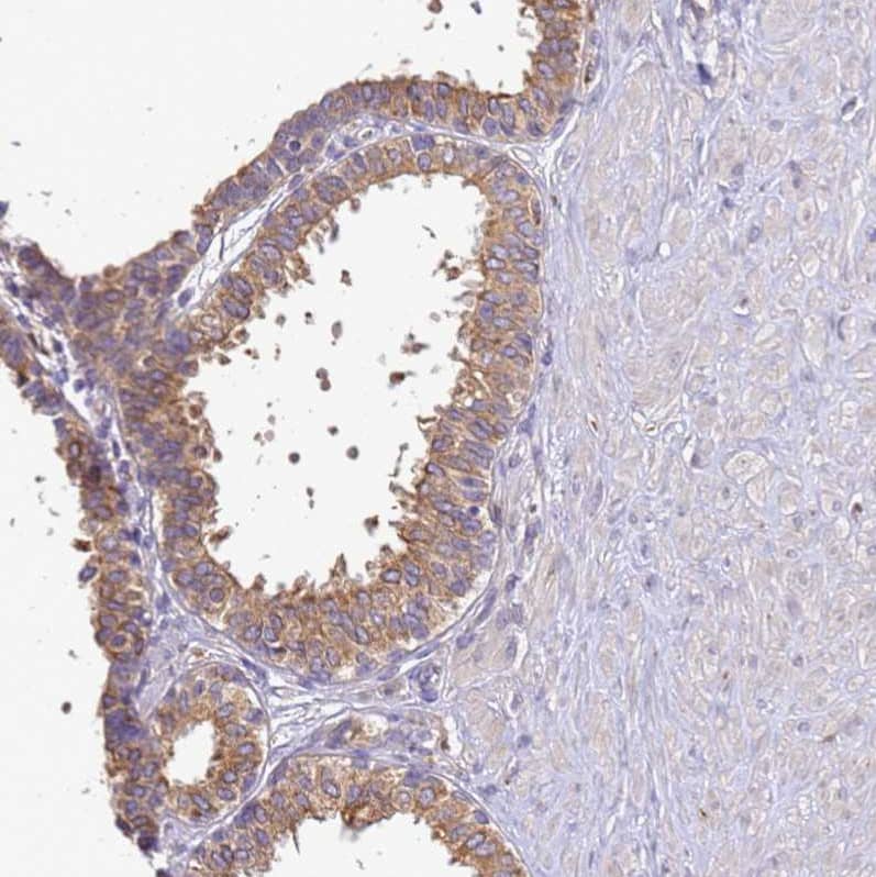 Staining of human prostate shows moderate  granular cytoplasmic positivity in  glandular cells.