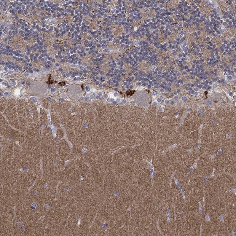 Staining of human cerebellum shows moderate cytoplasmic positivity in cells in molecular layer.