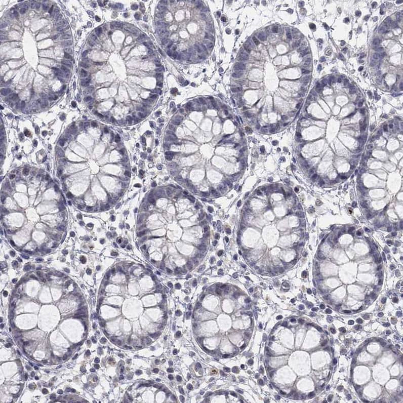 Staining of human rectum shows no positivity in glandular cells as expected.