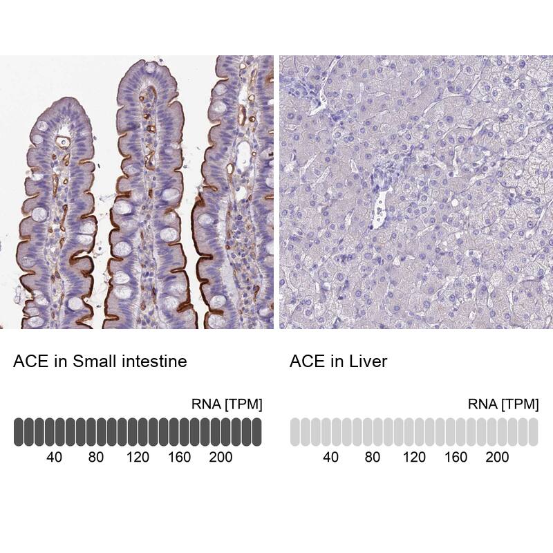 <b>Orthogonal Strategies Validation. </b>Analysis in human small intestine and liver tissues. Corresponding RNA-seq data are presented for the same tissues.
