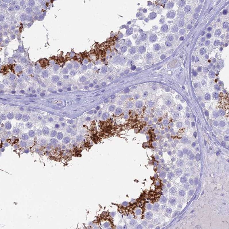 Staining of human testis shows strong membranous positivity in cells in seminiferous ducts.