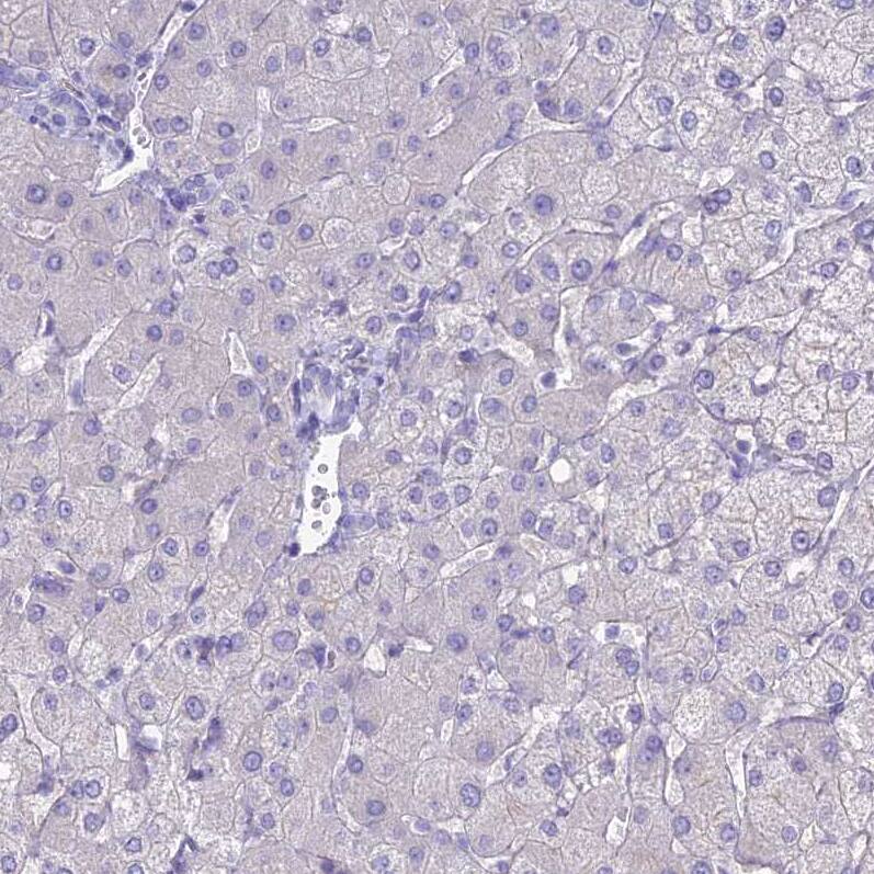 Staining of human liver shows no positivity in hepatocytes as expected.