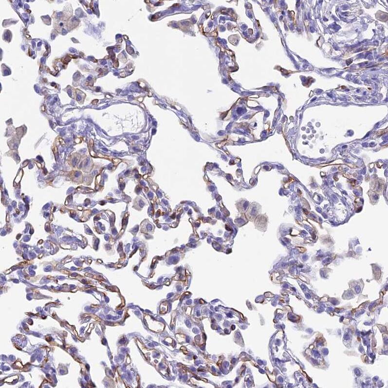 Staining of human lung shows moderate membranous positivity in pneumocytes.