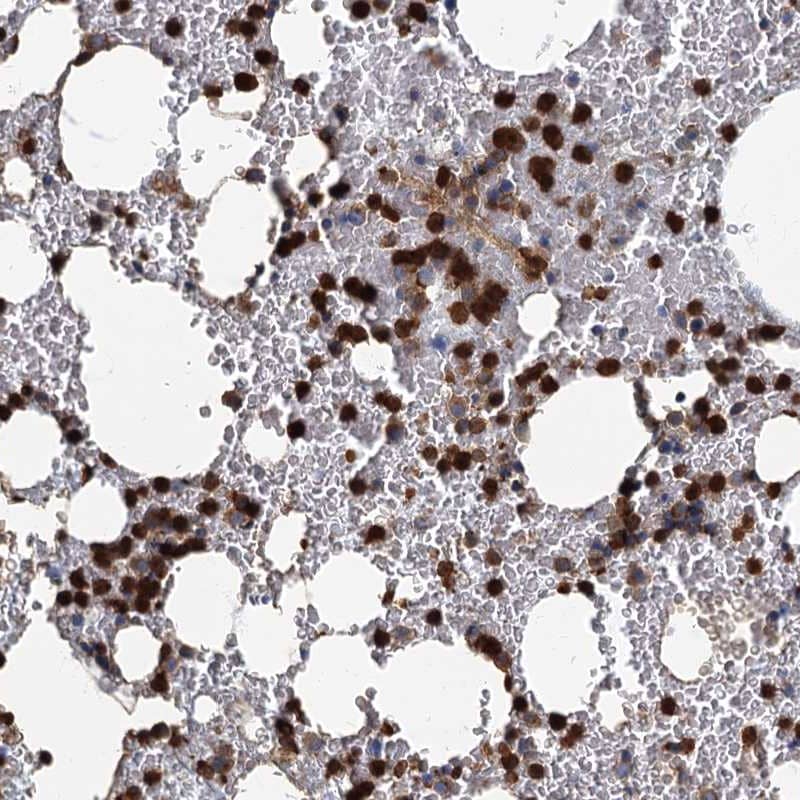 Immunohistochemistry-Paraffin ANKDD1A Antibody - BSA Free