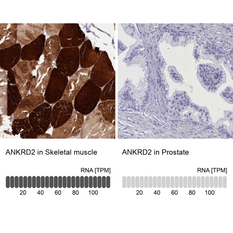 <b>Orthogonal Strategies Validation. </b>Analysis in human skeletal muscle and prostate tissues.