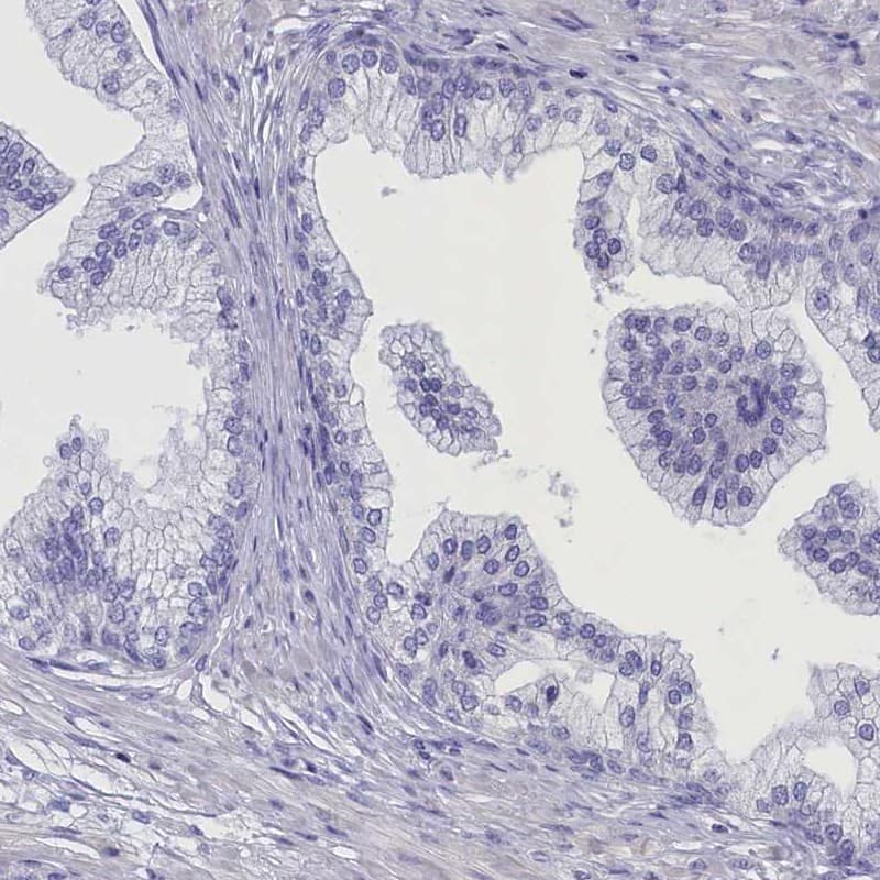 Staining of human prostate shows low expression as expected.