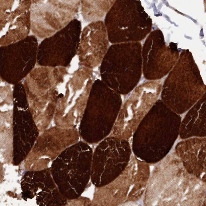 Staining of human skeletal muscle shows high expression.