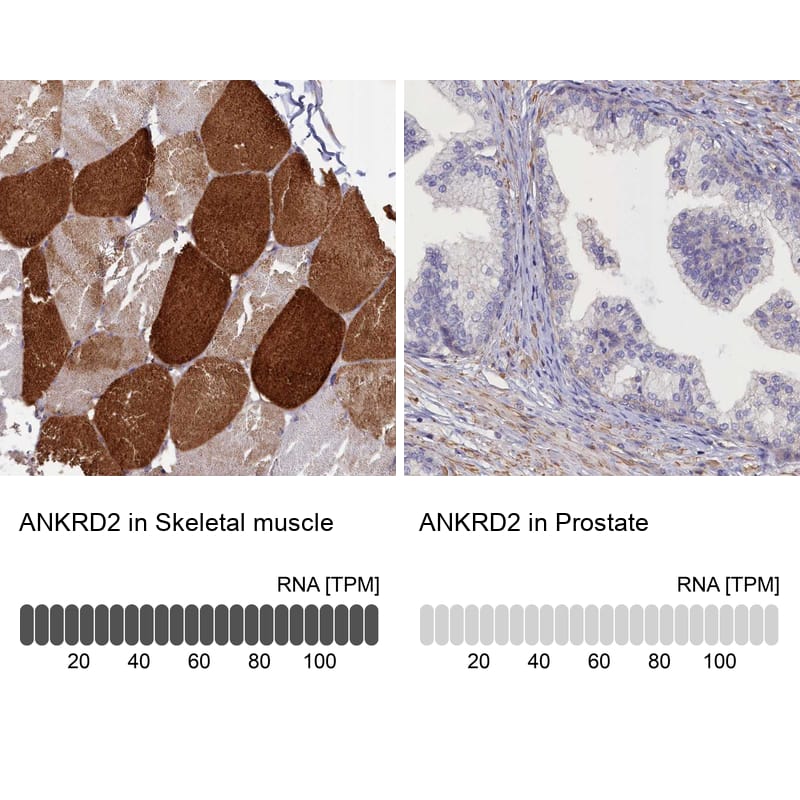 Immunohistochemistry-Paraffin ANKRD2 Antibody - BSA Free
