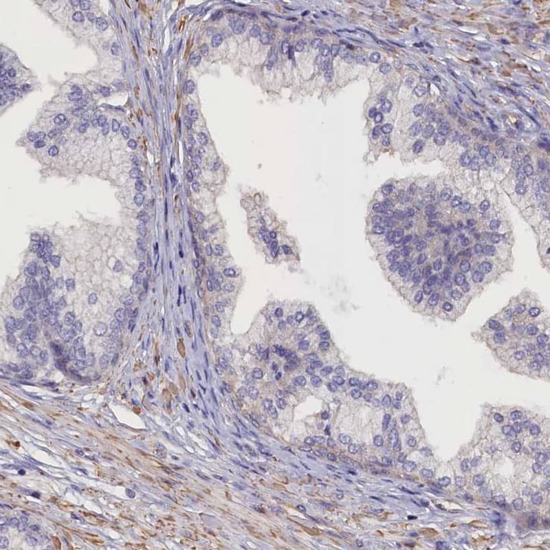 Staining of human prostate shows low expression as expected.