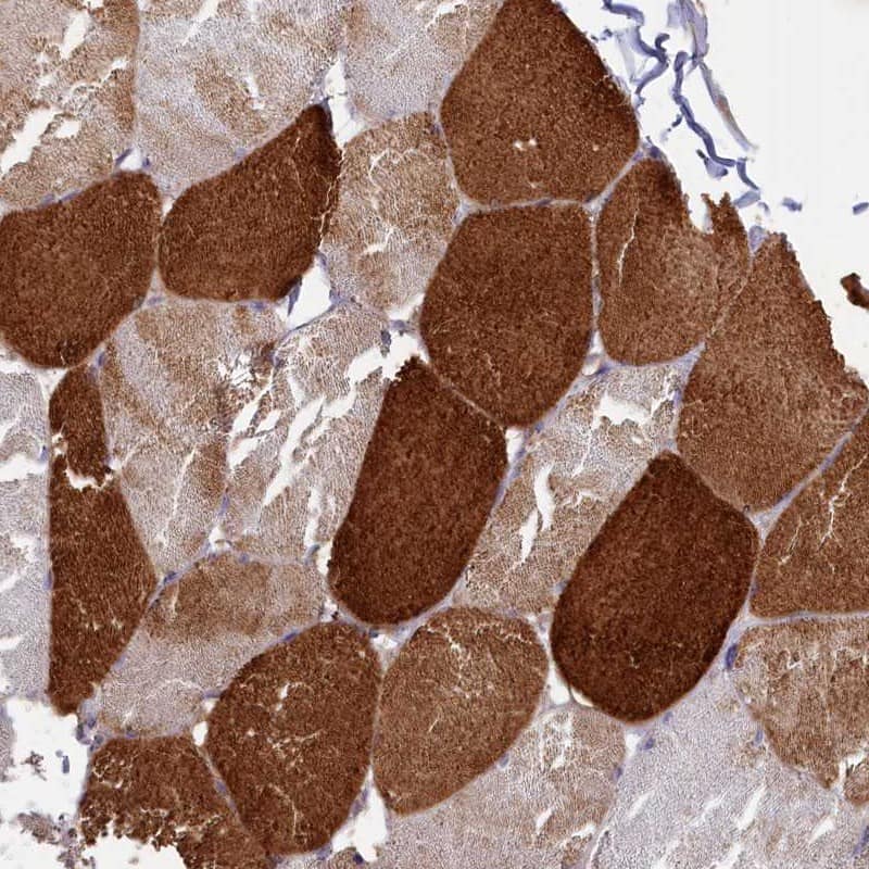 Staining of human skeletal muscle shows high expression.