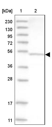 Western Blot Aspartyl Aminopeptidase Antibody - BSA Free