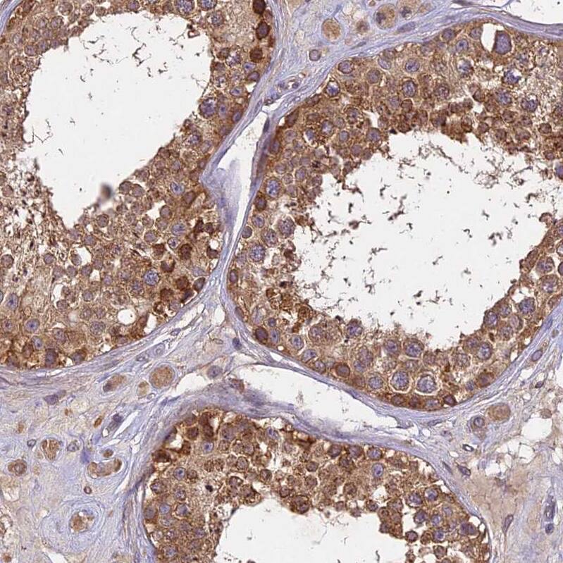 Staining of human testis shows strong cytoplasmic positivity in cells in seminiferous ducts.