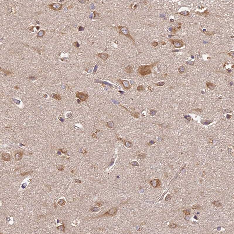 Staining of human cerebral cortex shows moderate cytoplasmic positivity in neurons.