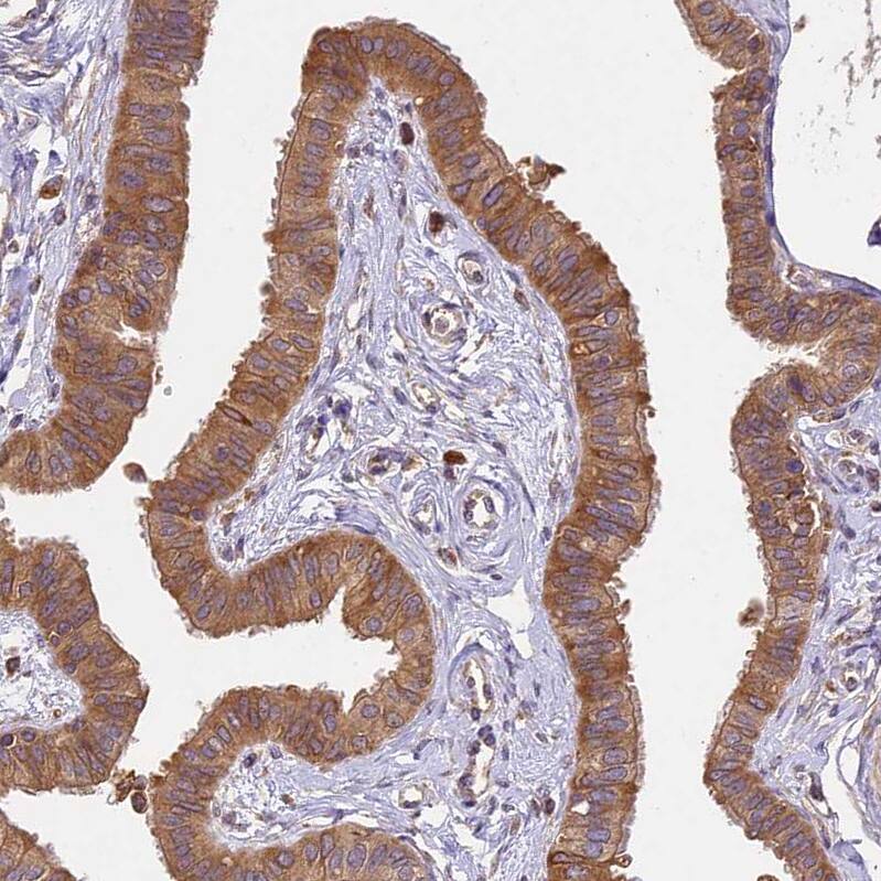 Staining of human Fallopian tube shows moderate cytoplasmic positivity in glandular cells.