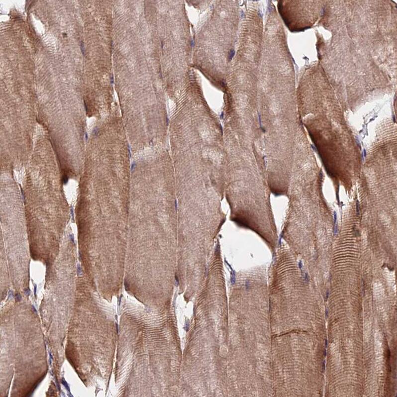 Staining of human skeletal muscle shows strong cytoplasmic positivity in myocytes.