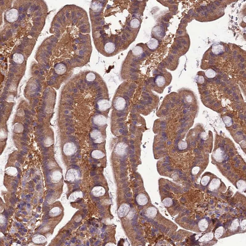 Staining of human Small intestine shows moderate granular cytoplasmic positivity in glandular cells.