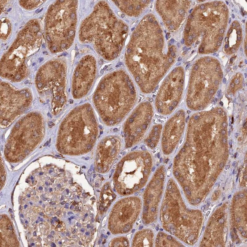 Staining of human Kidney shows moderate granular cytoplasmic positivity in cells in tubules.